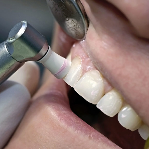 2-igiene-dentale2 2-igiene-dentale2