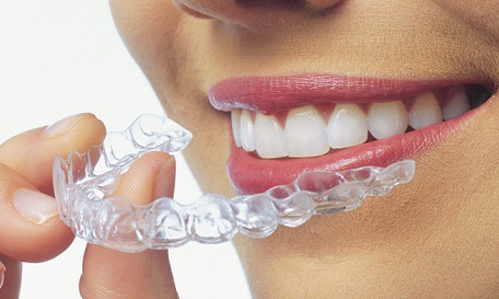 3-invisalign3